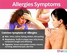 Image result for Stress Allergy Symptoms