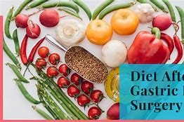 Image result for Stage 2B Gastric Bypass Diet