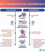 Image result for Gonorrhea and Chlamydia Naat