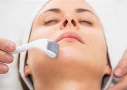 Image result for 36 Pin Micro Needling for Deep Wrinkles