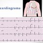 Image result for cardiogfama