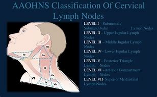 Image result for Level V Lymph Node
