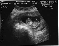 Image result for 47 Days Pregnant