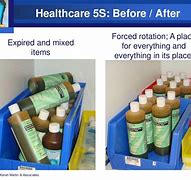 Image result for Before and After Shots 5S