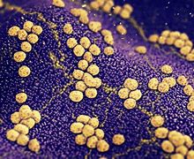 Image result for Folliculitis Staph Infection