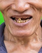 Image result for Ugly Teeth Smile