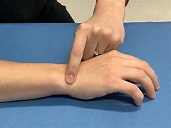 Image result for Hand Wrist Pain