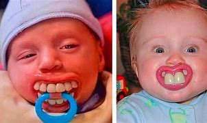Image result for Funny Baby Teeth