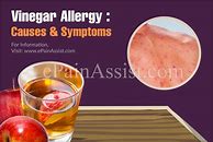 Image result for Vinegar Allergy
