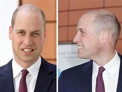 Image result for Prince William Bald with Beard