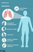 Image result for Emphysema Airway