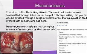 Image result for Mono Exudates