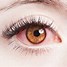 Image result for Contact Lens Stuck in Eye