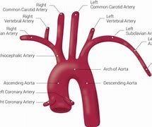 Image result for Subclavian Artery