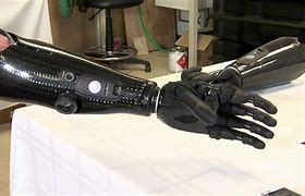Image result for Robotic Prosthetic Arm