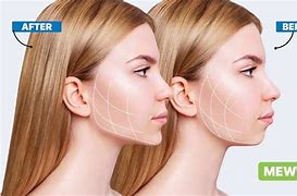 Image result for Mewing Long Face