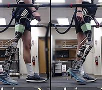 Image result for Artificial Intelligence Prosthetics