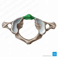 Image result for Anterior Arch of Atlas