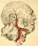 Image result for Carotid Arteries