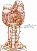 Image result for Arteries Anterior Middle Posterior Cerebral Basilar Internal Carotid Vertebral