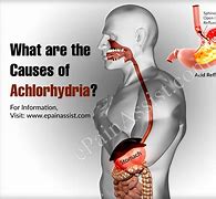 Image result for aclorhideia