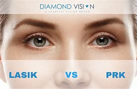 Image result for PRK vs Lasik
