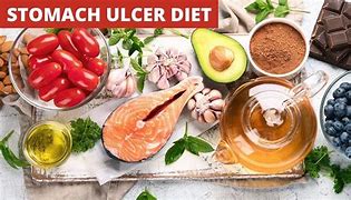 Image result for Best Diet for Stomach Ulcer