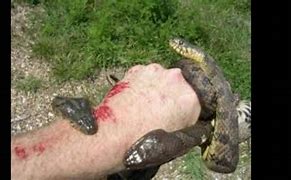 Image result for Biggest Snake Bite