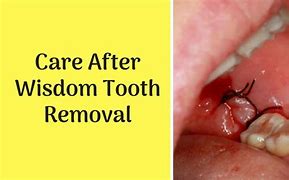 Image result for Tpot Two Sharp Teeth
