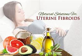 Image result for Best Treatment for Fibroids
