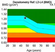 Image result for Bone Density Chart for Men