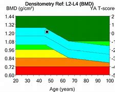 Image result for Bone Density Chart