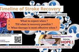 Image result for Stroke Recovery Timeline Chart