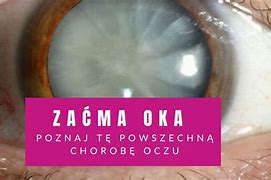Image result for co_to_znaczy_zaćma