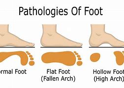 Image result for Running Foot vs Square Foot