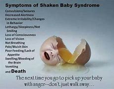 Image result for Shaken Baby Syndrome Pictures