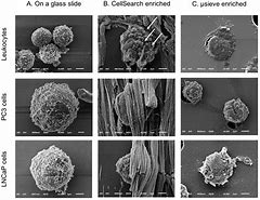 Image result for Circulating Tumor Cells