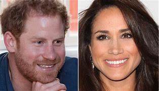 Image result for Does Prince Harry Wear a Toupee