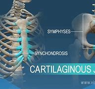 Image result for cartilahinoso