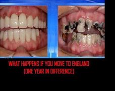 Image result for British Teeth Emoji