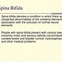Image result for Occult Spina Bifida