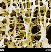 Image result for Skeleton Bone Anatomy