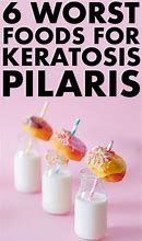 Image result for Foods That Cause Keratosis Pilaris