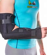 Image result for Full Arm Cast for ECU Injury