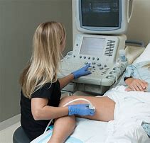 Image result for Vascular Ultrasound Machine