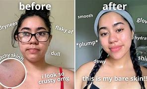 Image result for Skin Tone Glow Up