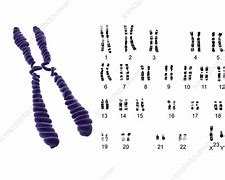 Image result for Boy Chromosome