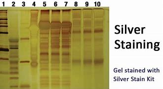 Image result for IP Silver Staining