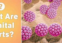 Image result for Male Genital Warts