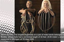 Image result for World Records Human Anatomy